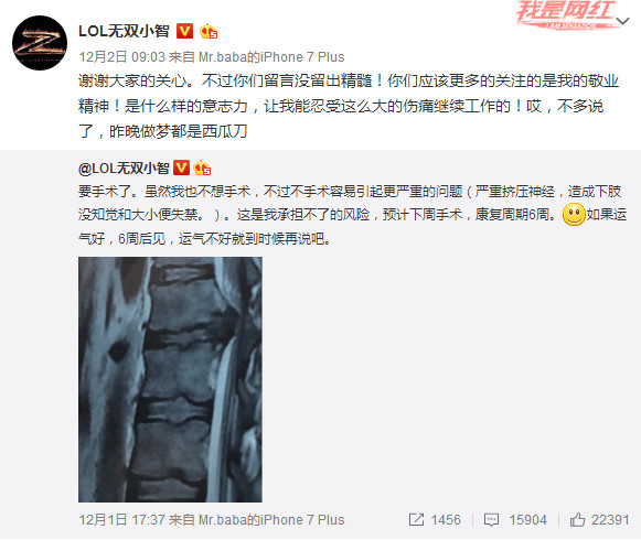 小智直播时查房阿怡 粉丝狂喊智嫂好