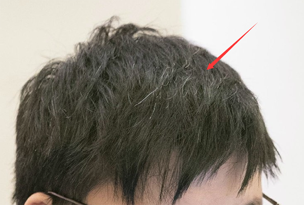 六年职业白了少年头 Uzi能否更进一步
