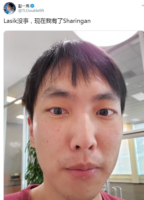 大师兄做完眼部手术，预知未来小组赛出线？G2：你该去看看医生